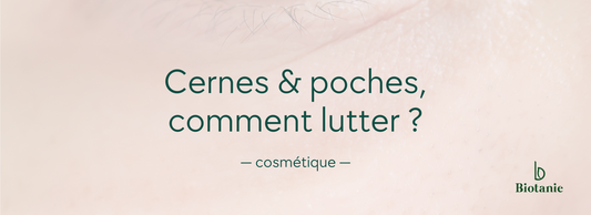 Cernes, poches, comment lutter ?